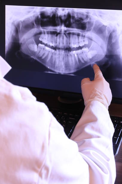Best Emergency Root Canal Treatment in Rancho Alegre, TX